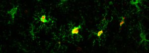 2 Prolif microglia prion detail