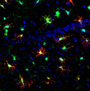 CD11c+ microglia in prion (from Gomez-Nicola et al., J Neurosci 2013)     
