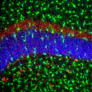 Overbooking in the Dentate Gyrus     