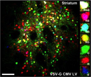 RGB-traced striatal neurons (from Gomez-Nicola et al., Sci Rep 2015)     