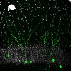 Retroviral-trcaed newborn neurons     