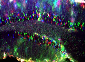 RGB-traced granule cells (from Gomez-Nicola et al., HGT 2015)     